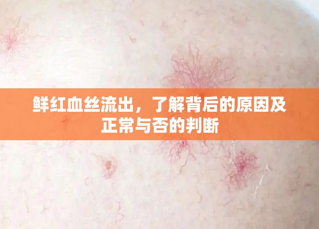 鮮紅血絲流出，了解背后的原因及正常與否的判斷