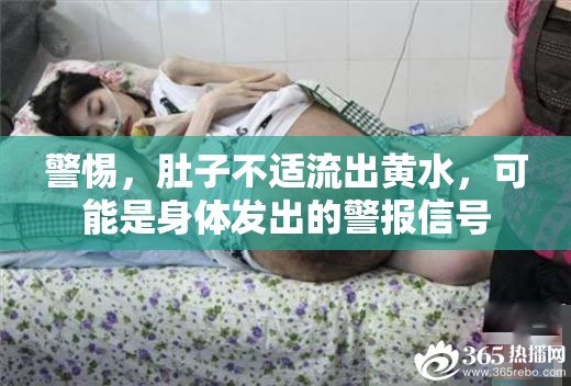 警惕，肚子不適流出黃水，可能是身體發(fā)出的警報(bào)信號(hào)