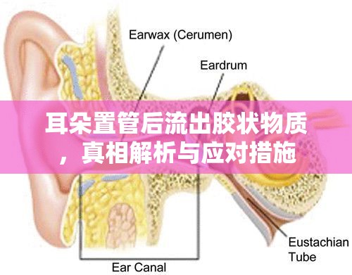耳朵置管后流出膠狀物質(zhì)，真相解析與應(yīng)對(duì)措施