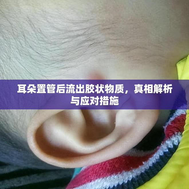 耳朵置管后流出膠狀物質(zhì)，真相解析與應(yīng)對(duì)措施