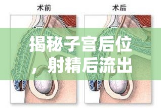 揭秘子宮后位，射精后流出的那些不為人知的秘密