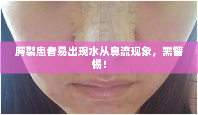腭裂患者易出現(xiàn)水從鼻流現(xiàn)象，需警惕！