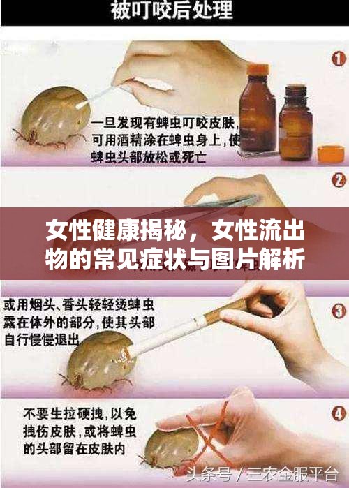 女性健康揭秘，女性流出物的常見癥狀與圖片解析