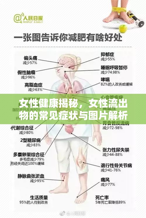 女性健康揭秘，女性流出物的常見癥狀與圖片解析