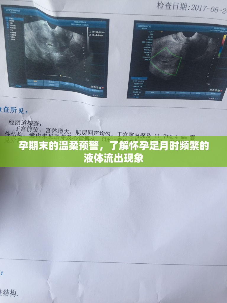 孕期末的溫柔預(yù)警，了解懷孕足月時頻繁的液體流出現(xiàn)象