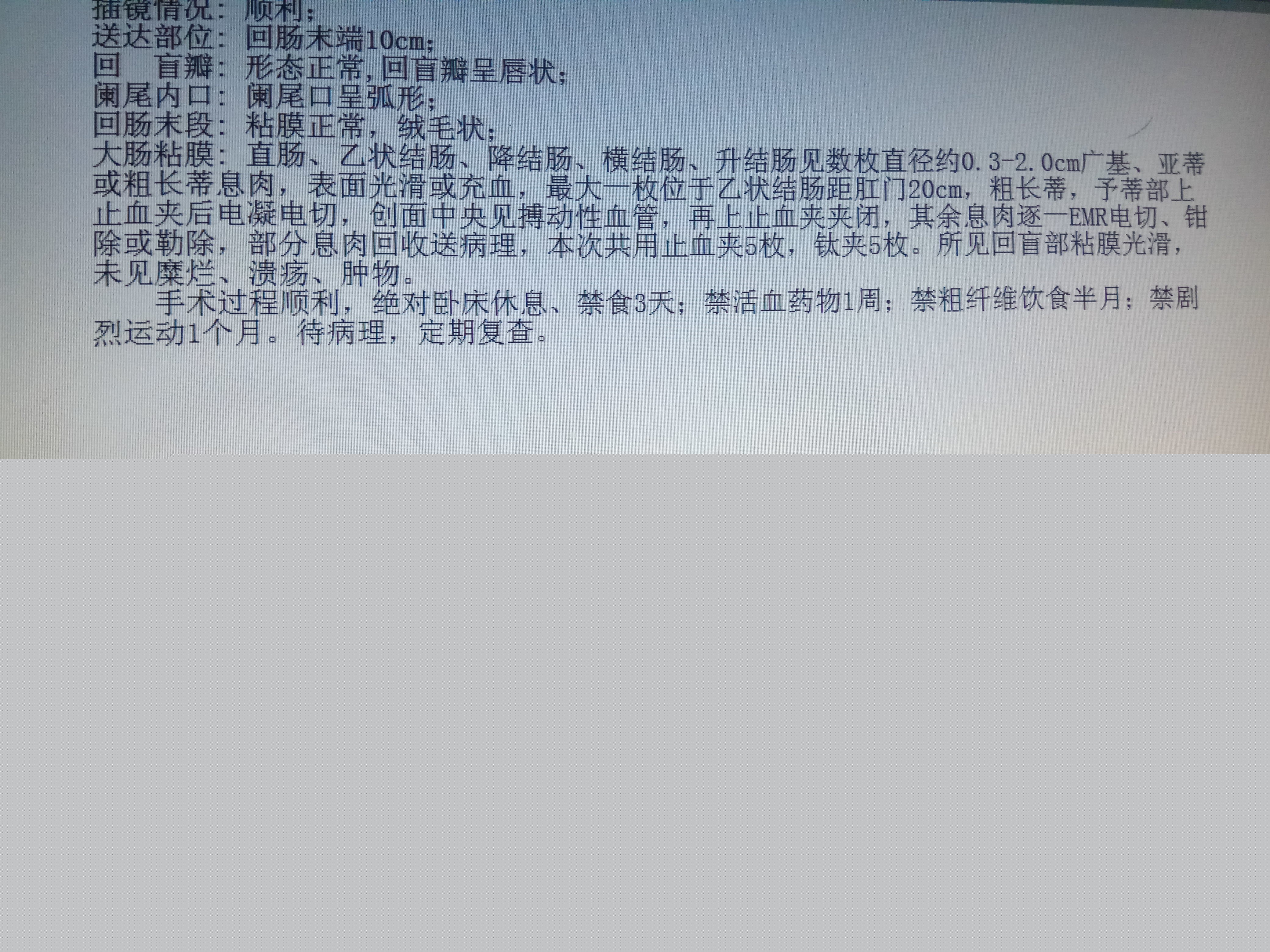 警惕肛周膿腫分泌物流出，不可忽視的健康警報