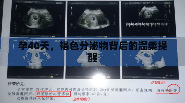 孕40天，褐色分泌物背后的溫柔提醒