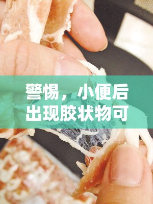 警惕，小便后出現(xiàn)膠狀物可能是健康問題的微妙信號