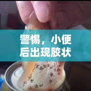 警惕，小便后出現(xiàn)膠狀物可能是健康問題的微妙信號