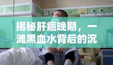 揭秘肝癌晚期，一灘黑血水背后的沉重真相