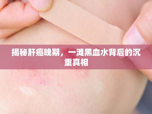 揭秘肝癌晚期，一灘黑血水背后的沉重真相