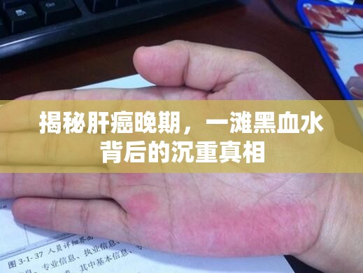 揭秘肝癌晚期，一灘黑血水背后的沉重真相