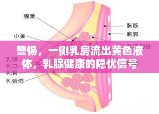 警惕，一側(cè)乳房流出黃色液體，乳腺健康的隱憂信號(hào)
