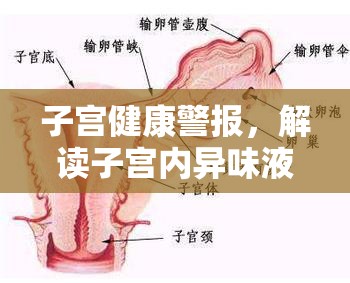 子宮健康警報(bào)，解讀子宮內(nèi)異味液體的成因與影響