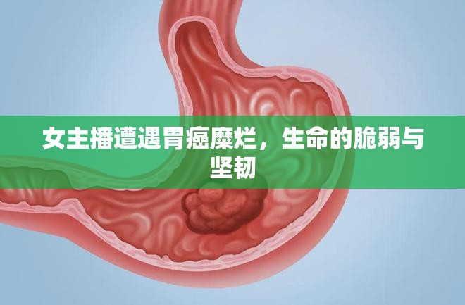 女主播遭遇胃癌糜爛，生命的脆弱與堅韌