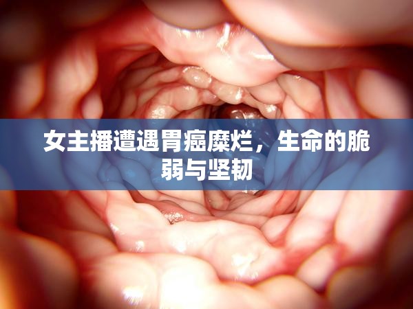 女主播遭遇胃癌糜爛，生命的脆弱與堅韌