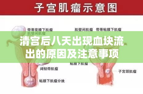 清宮后八天出現(xiàn)血塊流出的原因及注意事項