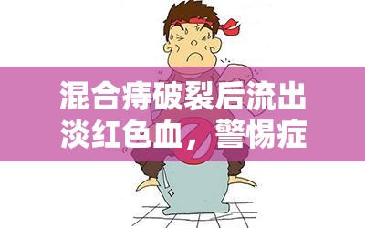 混合痔破裂后流出淡紅色血，警惕癥狀與預防措施