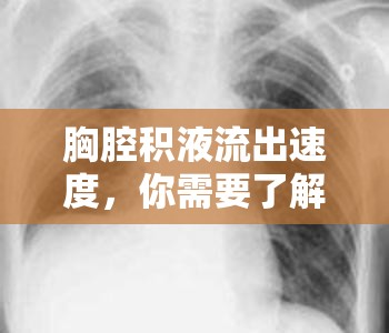 胸腔積液流出速度，你需要了解的真相