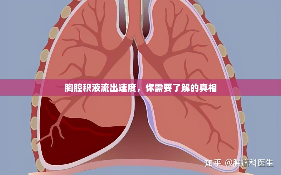胸腔積液流出速度，你需要了解的真相