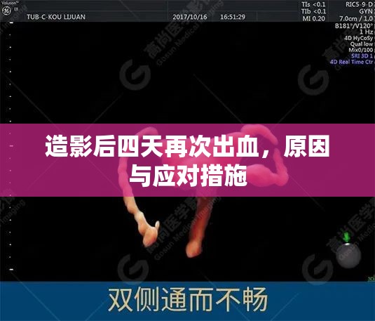 造影后四天再次出血，原因與應(yīng)對措施