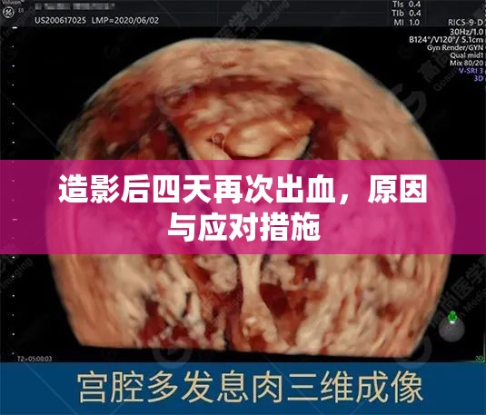 造影后四天再次出血，原因與應(yīng)對措施