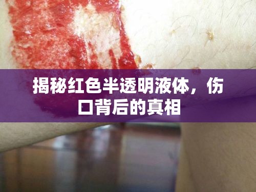 揭秘紅色半透明液體，傷口背后的真相