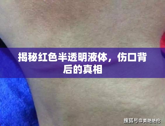 揭秘紅色半透明液體，傷口背后的真相