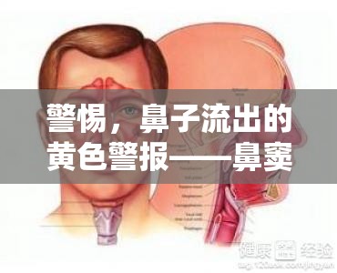 警惕，鼻子流出的黃色警報——鼻竇炎的真相與應對策略