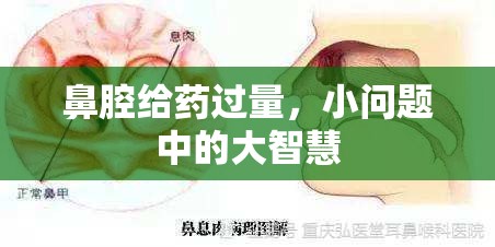 鼻腔給藥過量，小問題中的大智慧