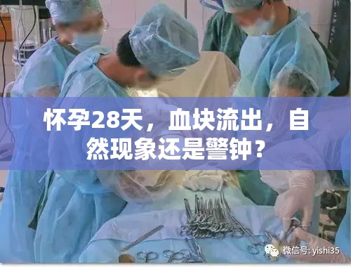 懷孕28天，血塊流出，自然現(xiàn)象還是警鐘？