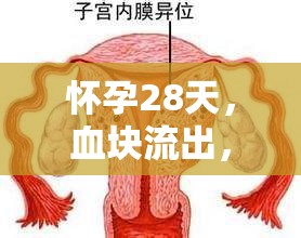 懷孕28天，血塊流出，自然現(xiàn)象還是警鐘？