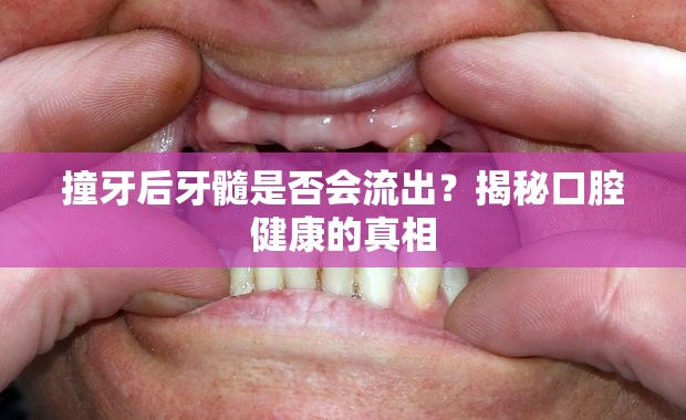 撞牙后牙髓是否會流出？揭秘口腔健康的真相