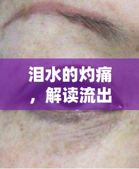 淚水的灼痛，解讀流出來(lái)的眼淚辣皮膚的背后故事