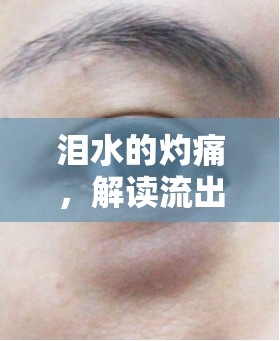 淚水的灼痛，解讀流出來(lái)的眼淚辣皮膚的背后故事