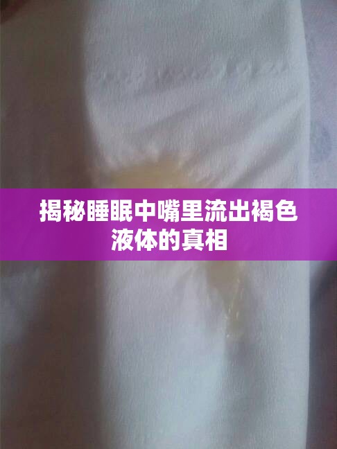 揭秘睡眠中嘴里流出褐色液體的真相