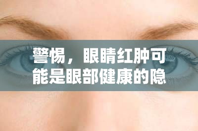 警惕，眼睛紅腫可能是眼部健康的隱形警報(bào)