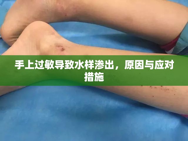 手上過敏導(dǎo)致水樣滲出，原因與應(yīng)對措施