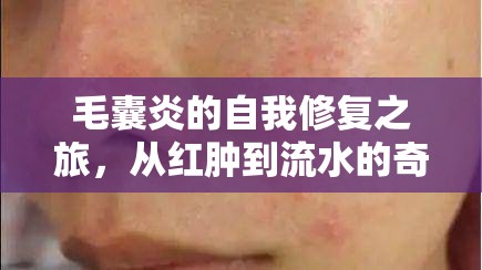 毛囊炎的自我修復(fù)之旅，從紅腫到流水的奇妙轉(zhuǎn)變