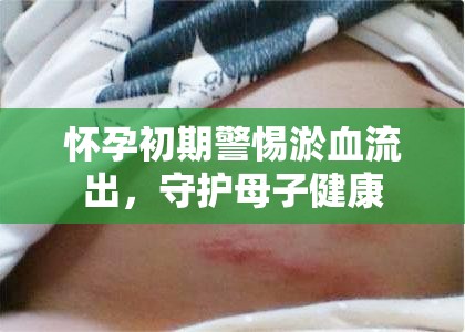 懷孕初期警惕淤血流出，守護(hù)母子健康