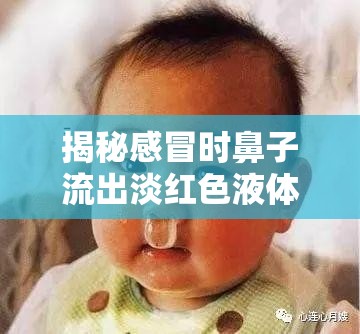 揭秘感冒時(shí)鼻子流出淡紅色液體的真相