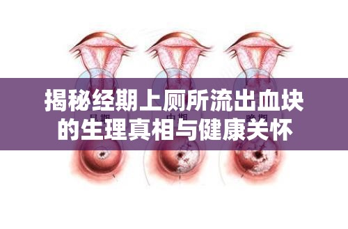 揭秘經(jīng)期上廁所流出血塊的生理真相與健康關(guān)懷