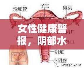 女性健康警報，陰部水樣分泌物與異味需警惕
