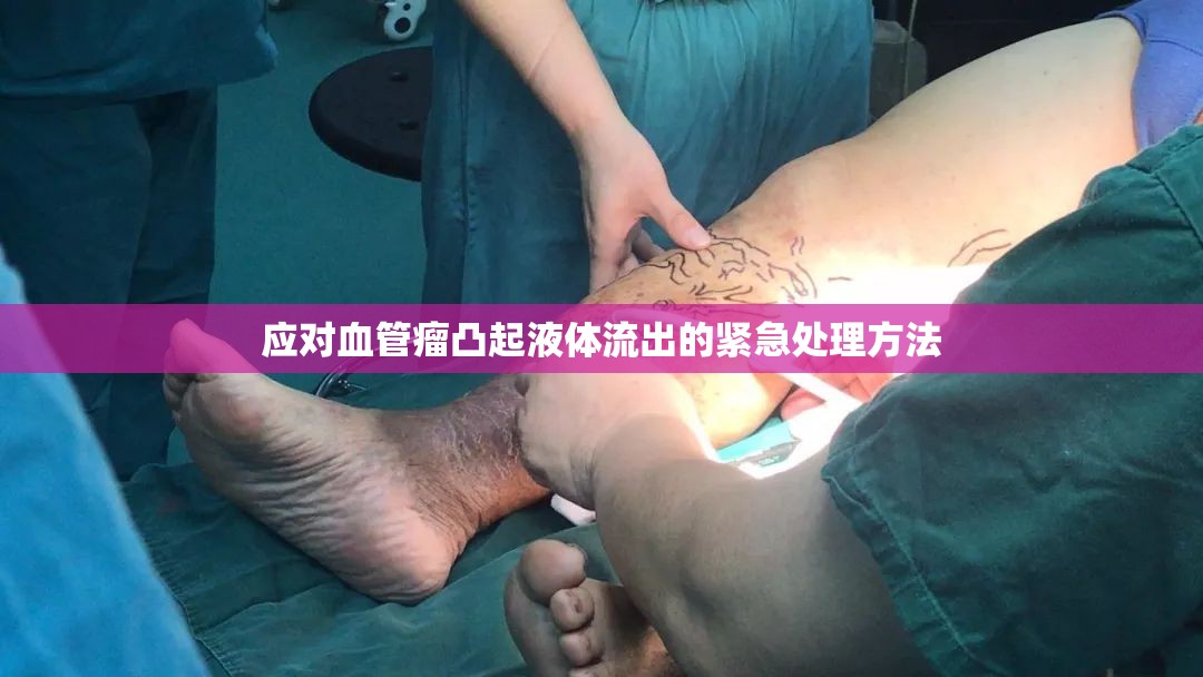 應(yīng)對血管瘤凸起液體流出的緊急處理方法