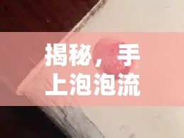 揭秘，手上泡泡流出的神秘液體真相