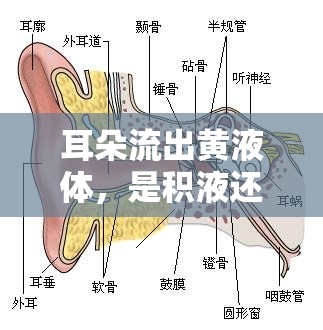 耳朵流出黃液體，是積液還是其他潛在癥狀？