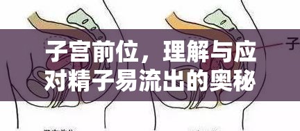 子宮前位，理解與應(yīng)對(duì)精子易流出的奧秘