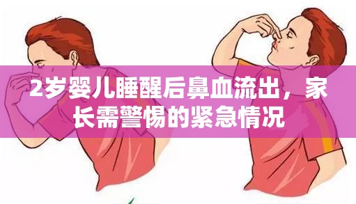 2歲嬰兒睡醒后鼻血流出，家長需警惕的緊急情況