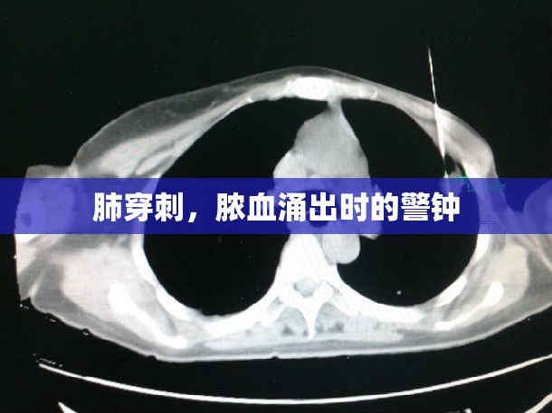 肺穿刺，膿血涌出時(shí)的警鐘