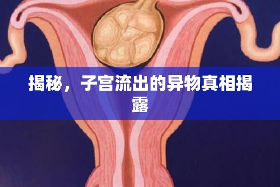 揭秘，子宮流出的異物真相揭露